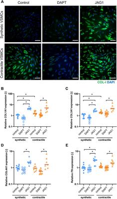 Notch signaling regulates strain-mediated phenotypic switching of vascular smooth muscle cells